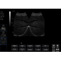 SONOSTAR SS-6B Ultraschallmaschine besser als SS-7